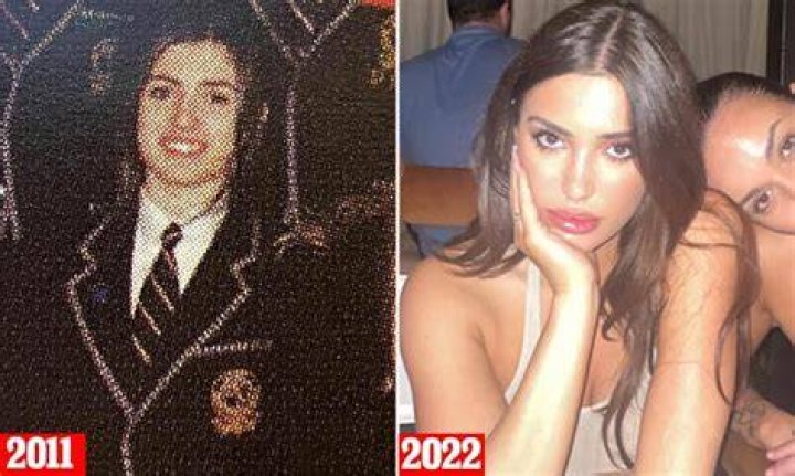 Bianca Censori Breast Implants: A Comprehensive Guide to Her Journey and Transformation