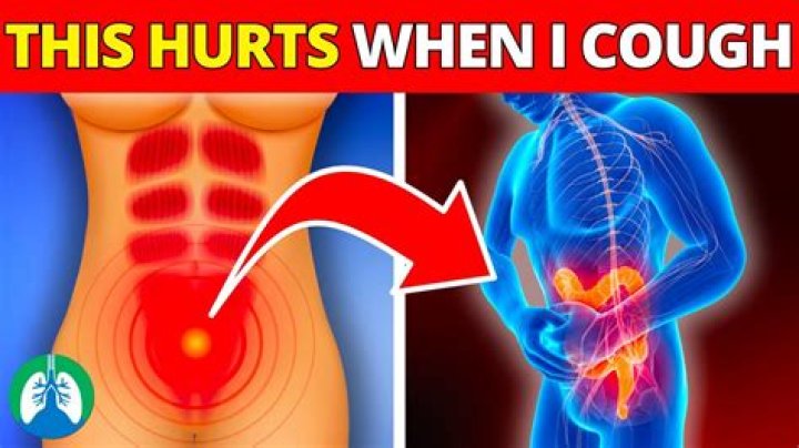 Can Coughing Cause Abdomen Pain? A Comprehensive Guide