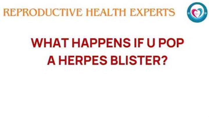 Can You Pop a Herpes Blister? Understanding the Risks and Proper Care