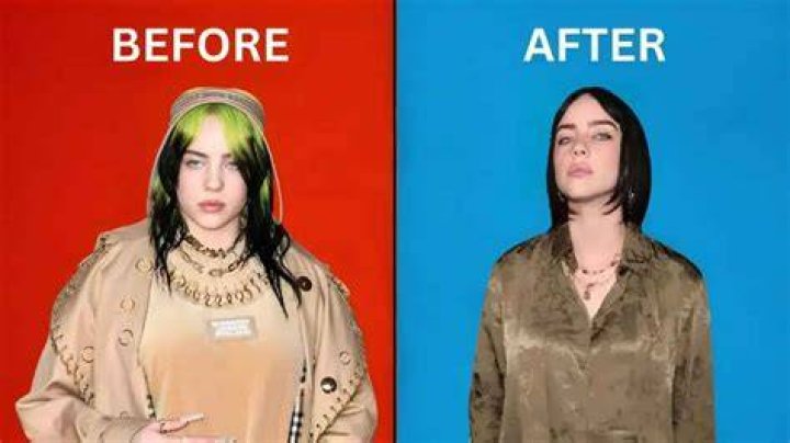 Did Billie Eilish Get Breast Reduction? Unveiling the Truth Behind the Rumors