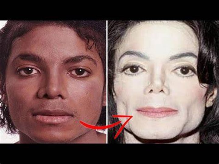 Did Michael Jackson Change His Skin Colour? Unveiling the Truth
