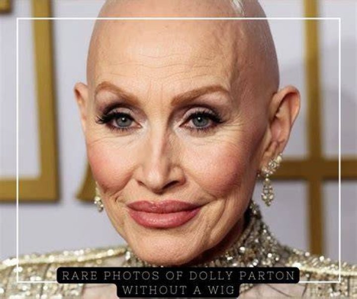 Dolly Parton Without Wig: The Untold Story Behind the Iconic Look