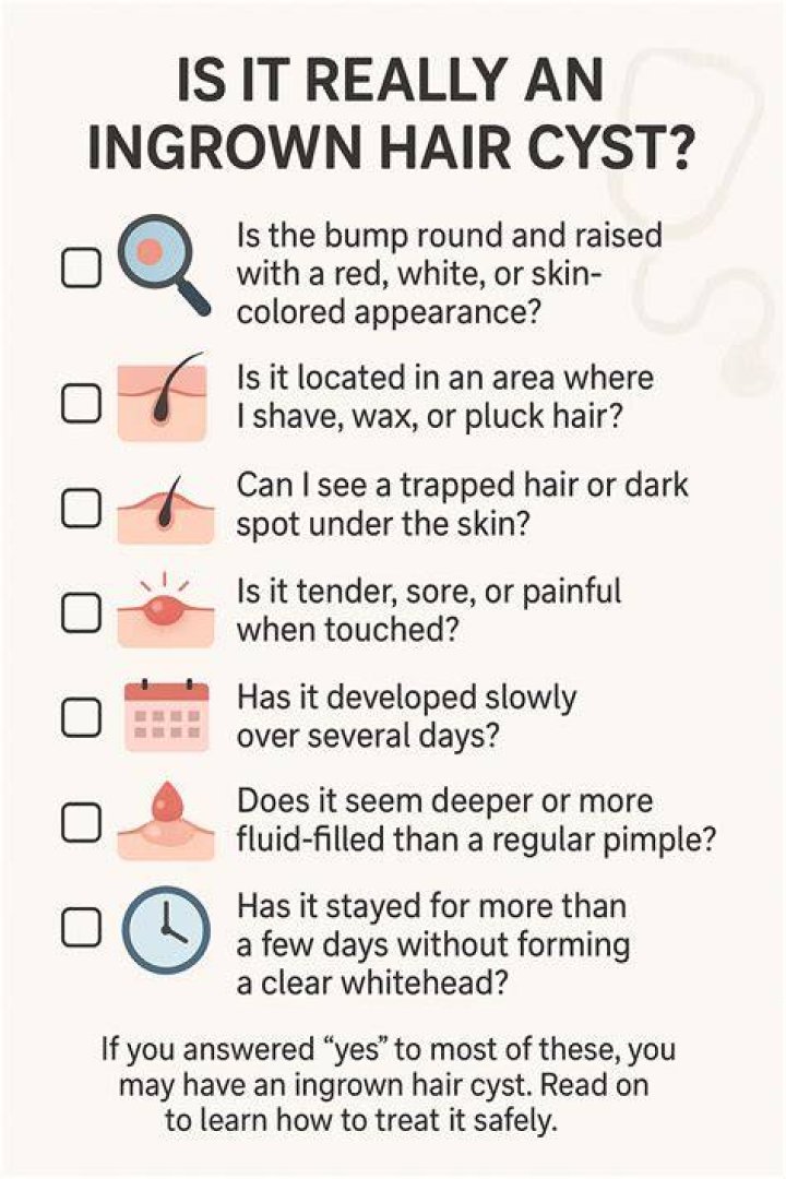 How to Heal Ingrown Hair Cyst: A Comprehensive Guide