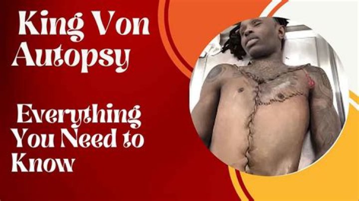 King Von Autopsy: A Comprehensive Analysis of the Life and Legacy of a Rising Star
