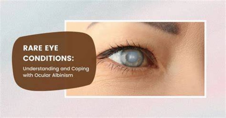 Mercedeschlapp Eye: The Ultimate Guide to Understanding This Rare Condition
