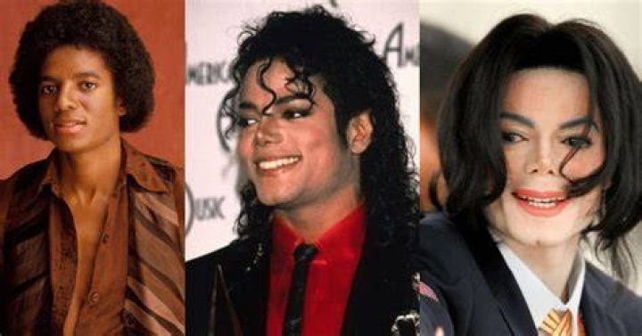 Michael Jackson's Battle with Vitiligo: A Comprehensive Look into His Journey