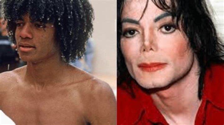 Michael Jackson's Health Battles: Unveiling the Diseases That Shaped the King of Pop's Journey