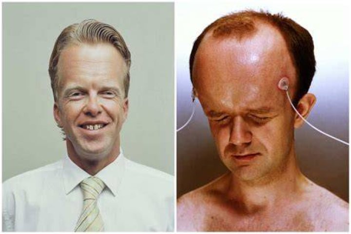 The Biggest Forehead in the World: Discovering an Extraordinary Trait