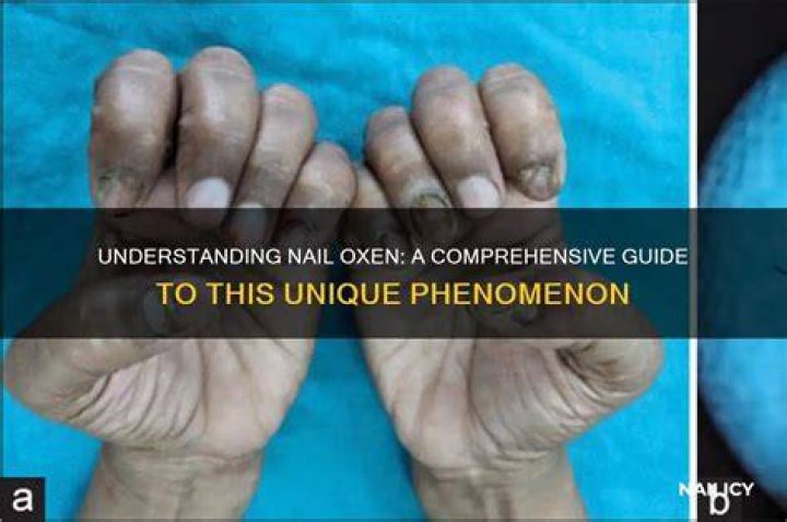 Understanding Magnumerie: A Comprehensive Guide to This Unique Phenomenon