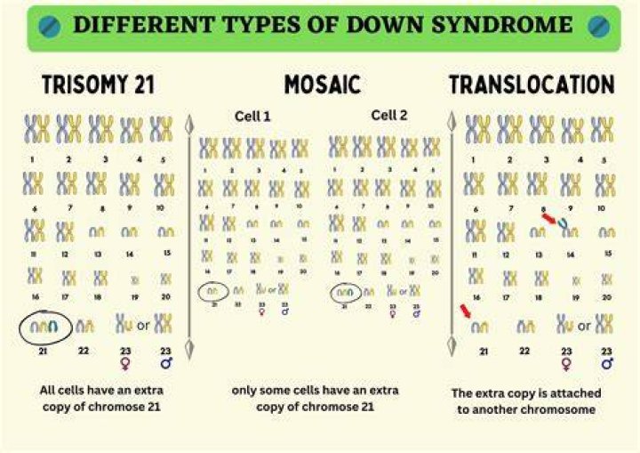 Understanding Trisomy 13 Mosaicism: Causes, Symptoms, Diagnosis, and Management