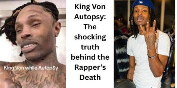 Von's Autopsy Pics: Unveiling the Truth Behind the Controversy