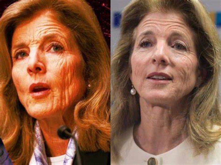 What Happened to Caroline Kennedy's Face: A Comprehensive Exploration