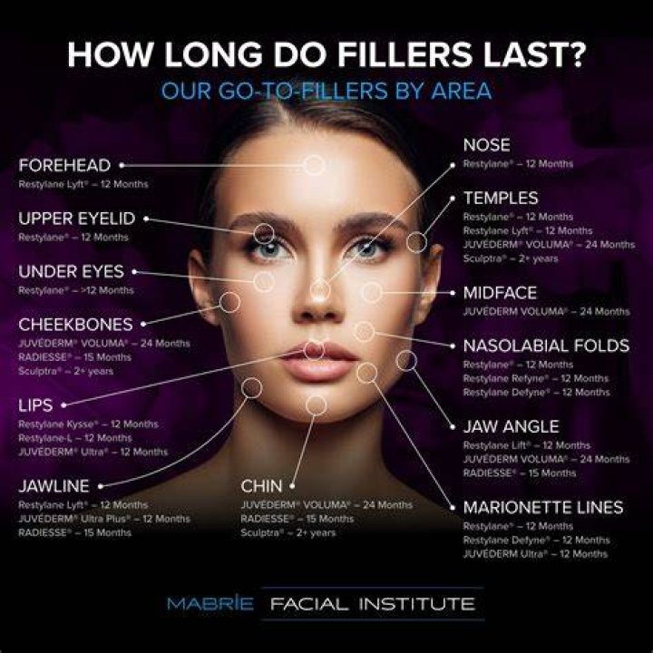 What Happens to Fillers Over Time: A Comprehensive Guide
